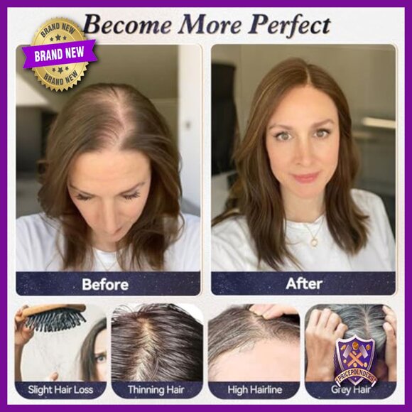 10 Inch Human Hair Topper for Thinning Hair, Swiss Lace Base, No Bangs main image 6